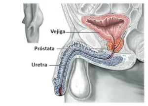 Prostata